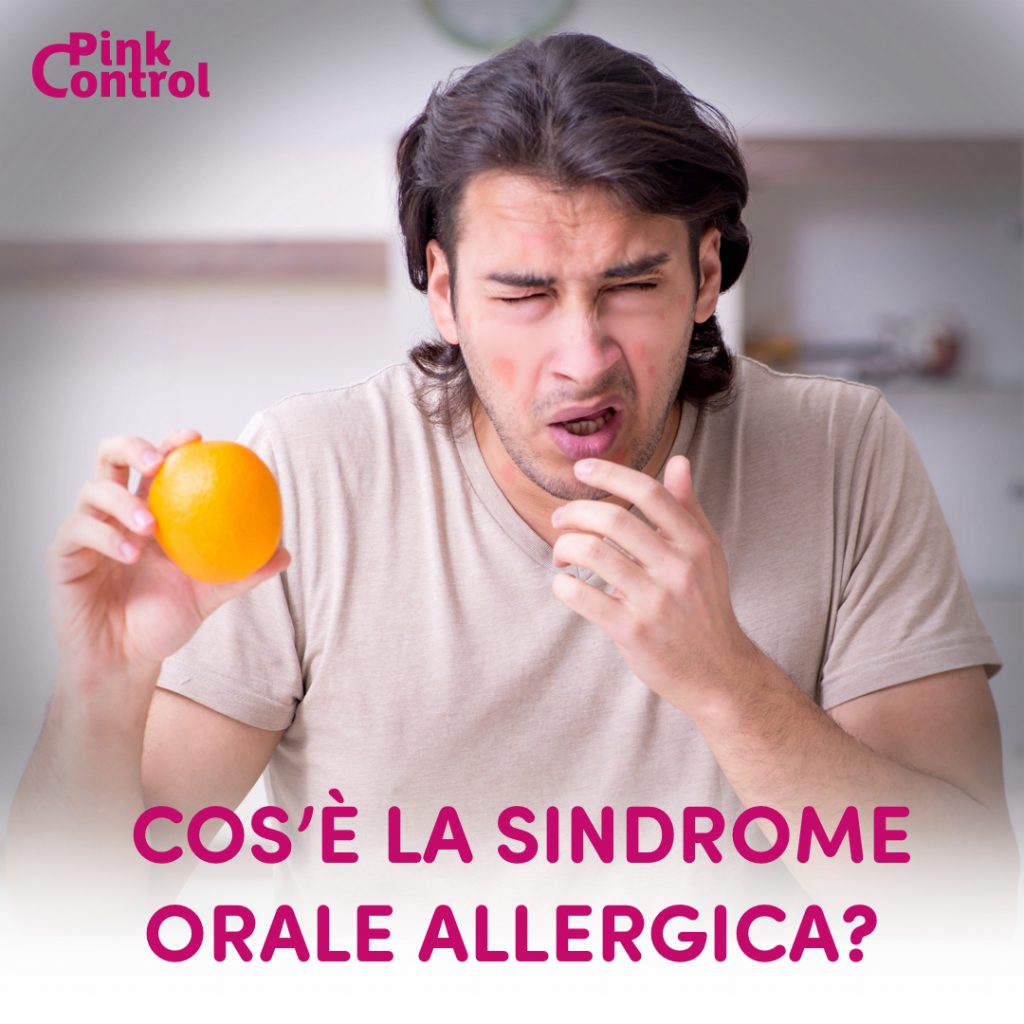 Sindrome Orale Allergica